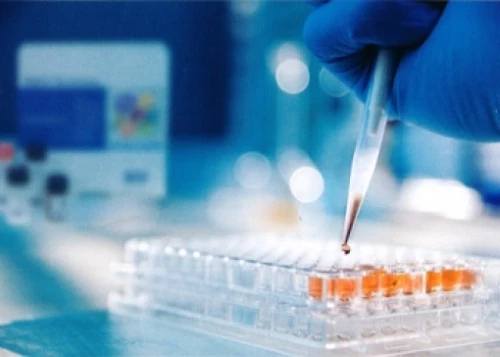 DuoSet® ELISA Development Systems