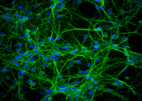 Lektyny & Neuronal Tracing