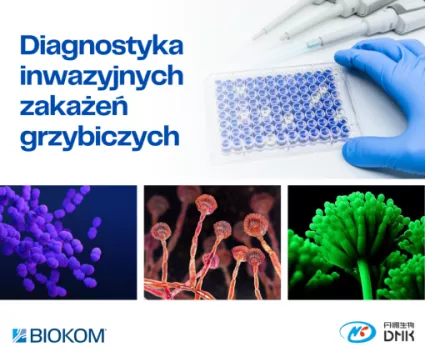 Diagnostyka inwazyjnych zakażeń grzybiczych - testy