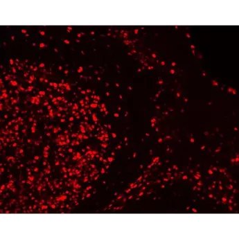 Vector | 1 Kit | DK-1594 | VectaFluor Excel Amplified Anti-Rabbit IgG, DyLight™ 594 Antibody Kit, 1 Kit