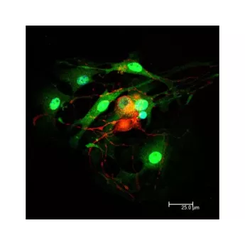 Vector | 1.5 mg | DI-2594-1.5 | Horse Anti-Mouse IgG Antibody (H+L), DyLight™ 594, 1.5 mg