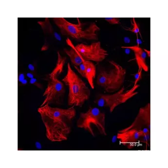 Vector | 1.5 mg | DI-1094-1.5 | Horse Anti-Rabbit IgG Antibody (H+L), DyLight™ 594, 1.5 mg