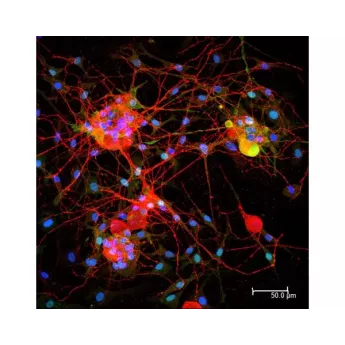 Vector | 1.5 mg | DI-3094-1.5 | Horse Anti-Goat IgG Antibody (H+L), DyLight™ 594, 1.5 mg