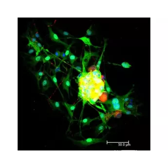 Vector | 1.5 mg | DI-2549-1.5 | Horse Anti-Mouse IgG Antibody (H+L), DyLight™ 549, 1.5 mg