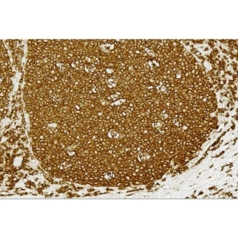 Vector | 1 Kit | PK-8200 | VECTASTAIN® Elite® ABC Universal PLUS Kit, Peroxidase (Horse Anti-Mouse/Rabbit IgG), 1 Kit