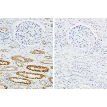 Vector | 1 kit | HOH-3000 | H.O.H.™ (Human on Human) Immunodetection Kit, 1 Kit