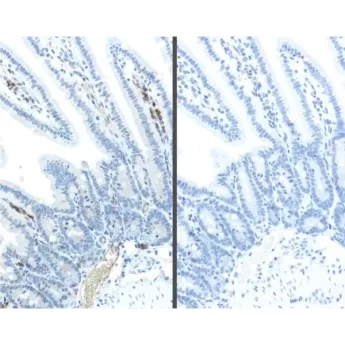 Vector | 1 Kit | MP-2400 | M.O.M.® (Mouse on Mouse) ImmPRESS®-HRP (Peroxidase) Polymer Kit, 1 Kit