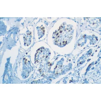 Vector | 1 Kit | PK-7800 | VECTASTAIN® Universal Quick HRP Kit, Peroxidase, R.T.U. , 1 Kit