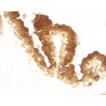 Vector | 1 Kit | SK-4100 | DAB Substrate Kit, Peroxidase (HRP), with Nickel, (3,3'-diaminobenzidine), 1 Kit