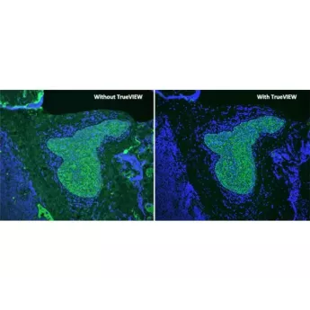 Vector | 15 ml | SP-8500-15 | Vector® TrueVIEW® Autofluorescence Quenching Kit with DAPI, 1 kit